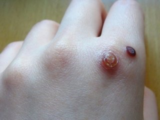 ڵѰʲôӵ